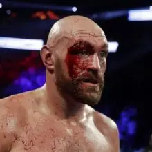 Тайсон Фьюри